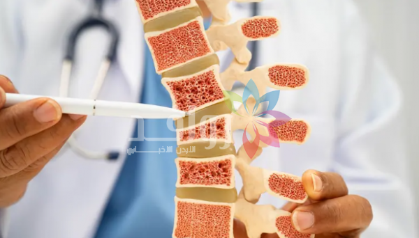 هشاشة العظام في رمضان .. التعويض الآمن والمدروس