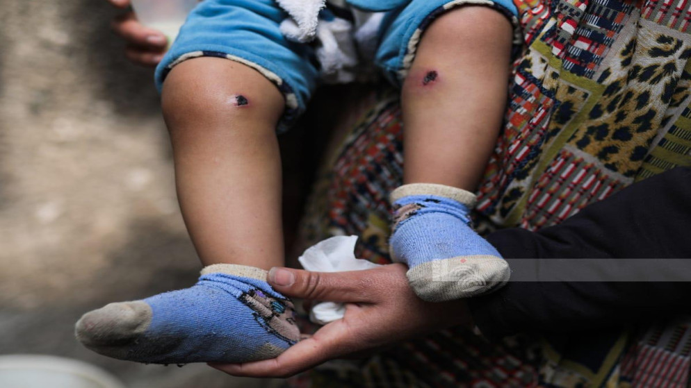 غزة: قصة اختطاف أب وابنه وإعادة الطفل بأقدام محروقة