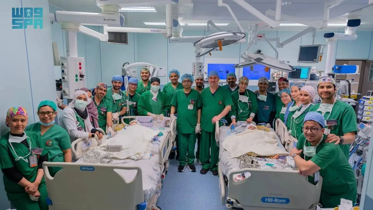 نجاح سعودي: فصل التوأم الفلبيني الملتصق بعملية معقدة بالرياض