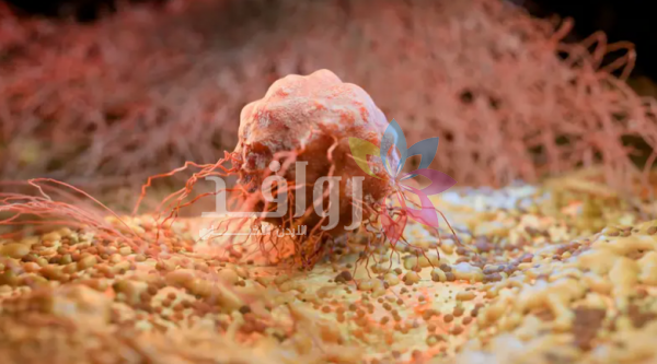 اكتشاف علمي .. نوع رابع من السرطان ينتقل بالعدوى