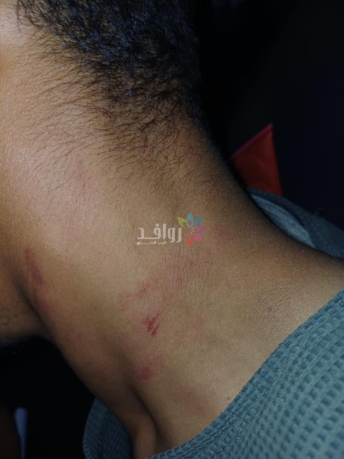 اعتداء جديد على عامل وطن أثناء تأديته واجبه في اربد